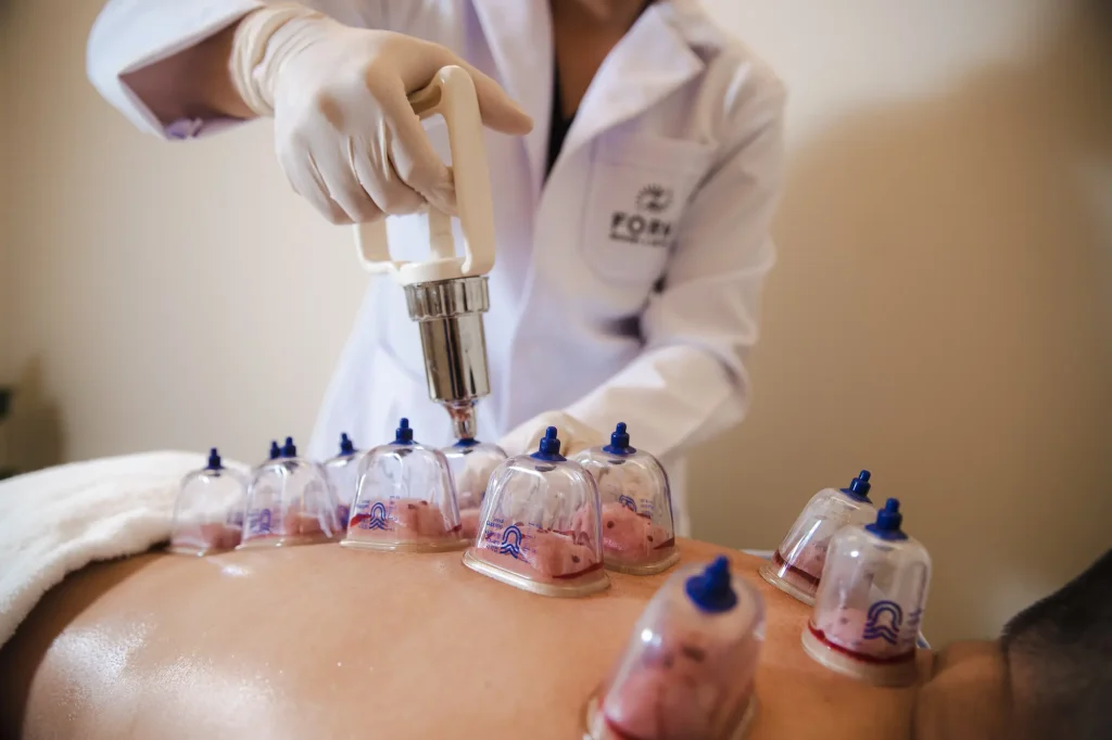 Wet Cupping Therapy: Evidence-Based Training for Clinical Application
